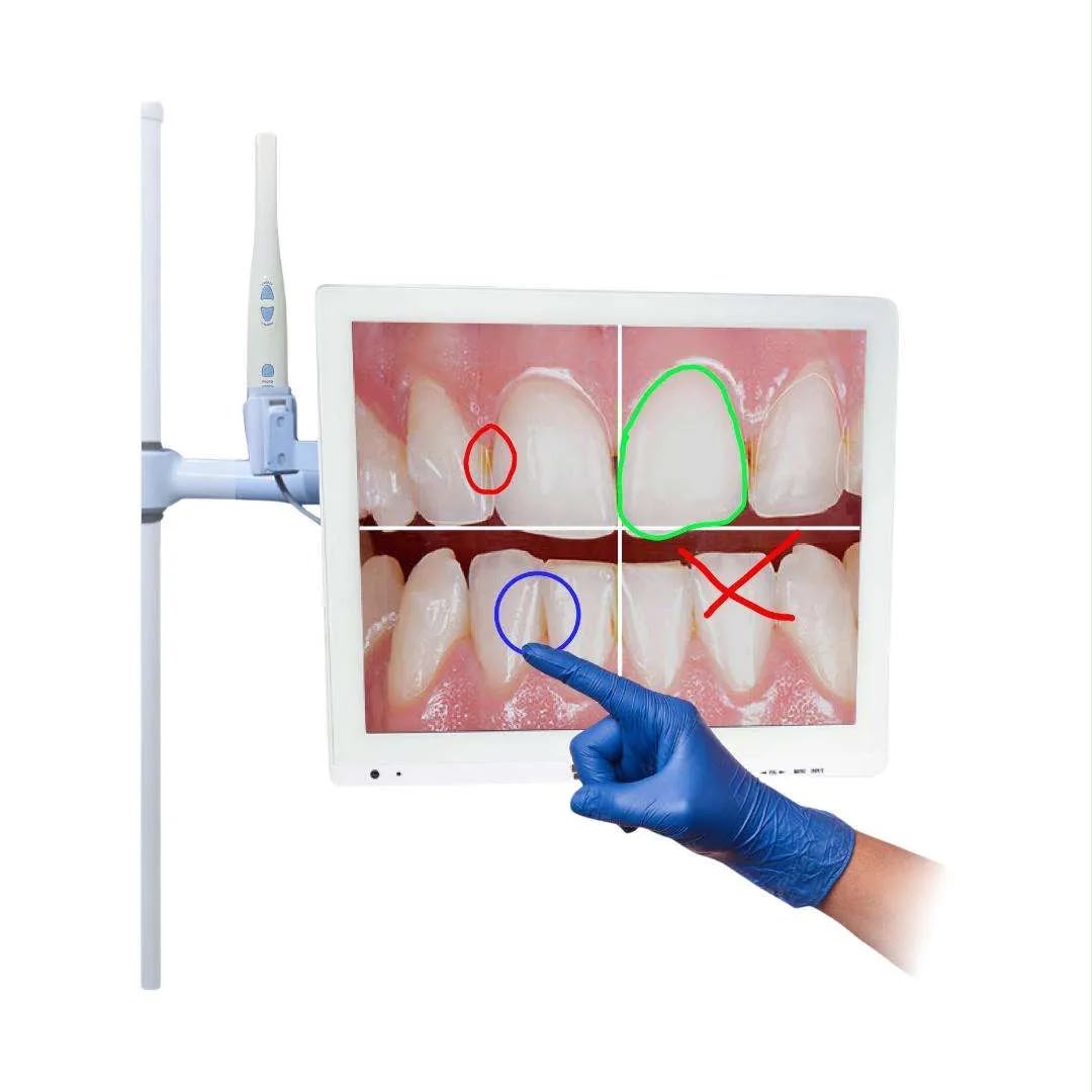 Cámara intraoral